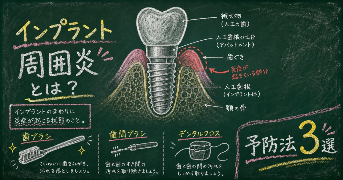 歯茎の出血は危険信号？インプラント周囲炎の原因と予防法3選