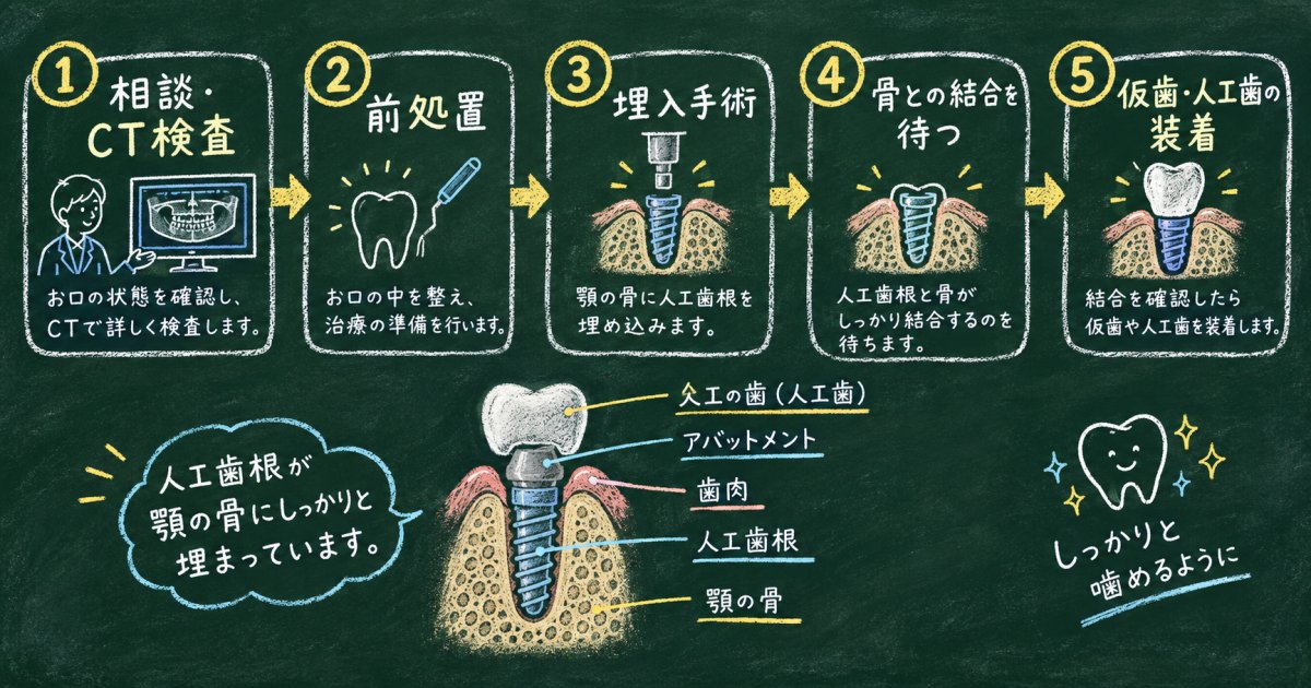 インプラント治療の流れ｜初診から人工歯の装着まで